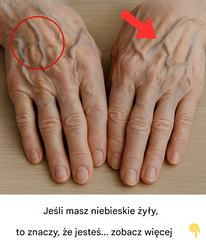 Dlaczego żyły stają się bardziej widoczne z wiekiem