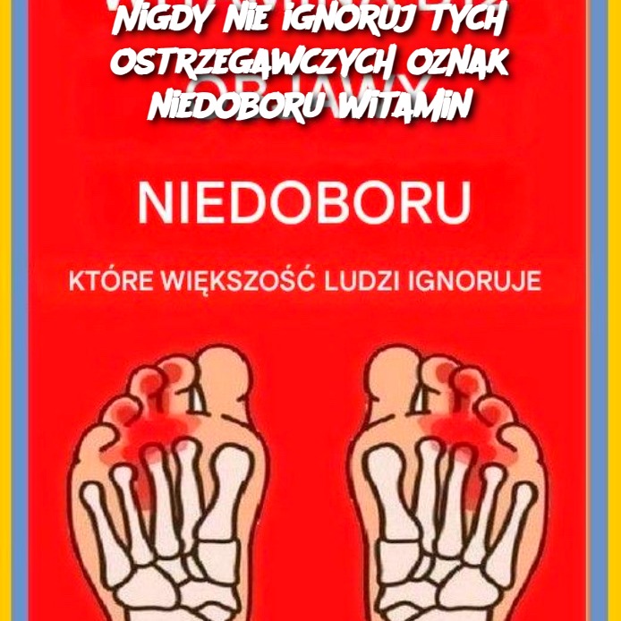Nigdy nie ignoruj ​​tych ostrzegawczych oznak niedoboru witamin