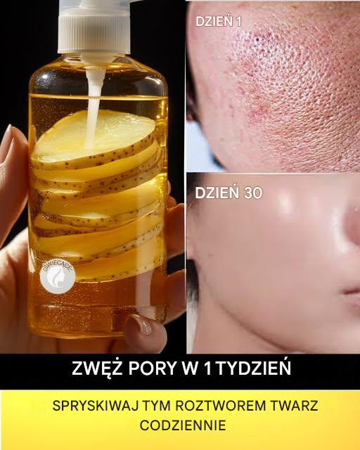 5 domowych toników do skóry, które rozświetlą cerę, pomogą pozbyć się trądziku i przebarwień
