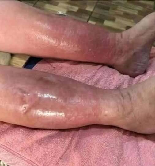 To wyraźne oznaki, że jest on…