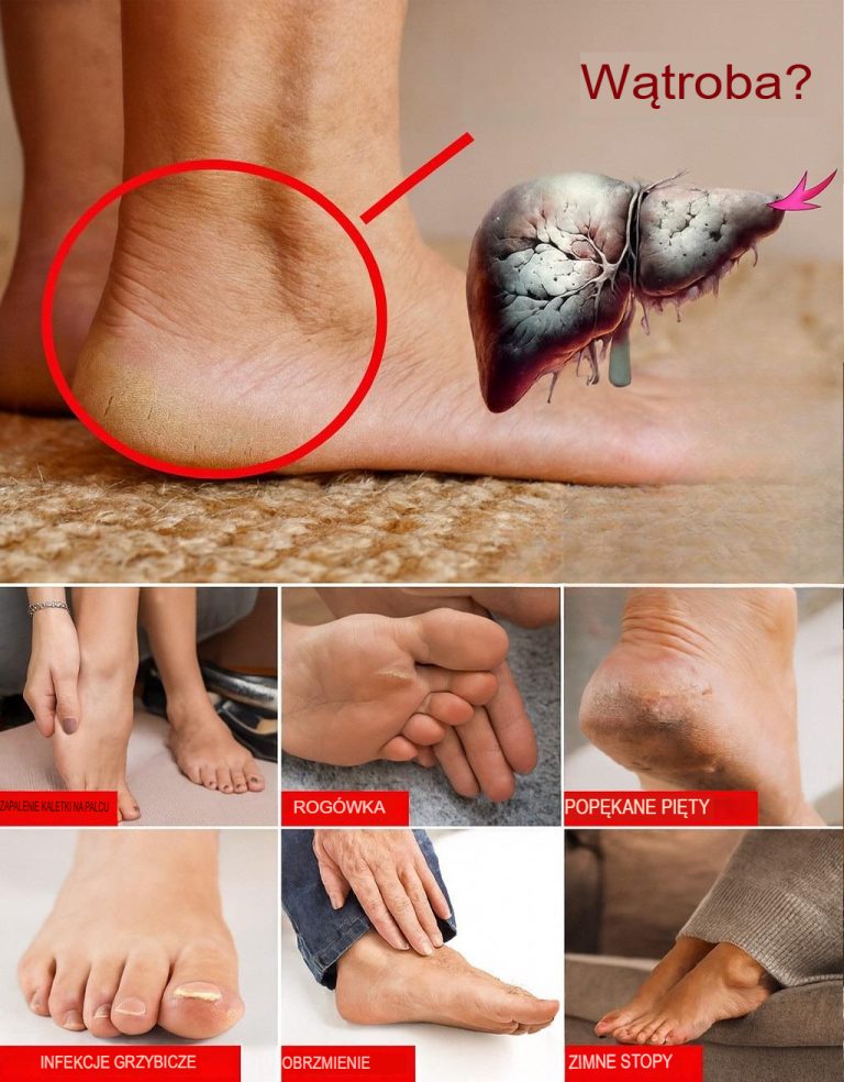 Twoje stopy wołają o uwagę: 6 szokujących sygnałów zdrowotnych ukrytych w podeszwach!