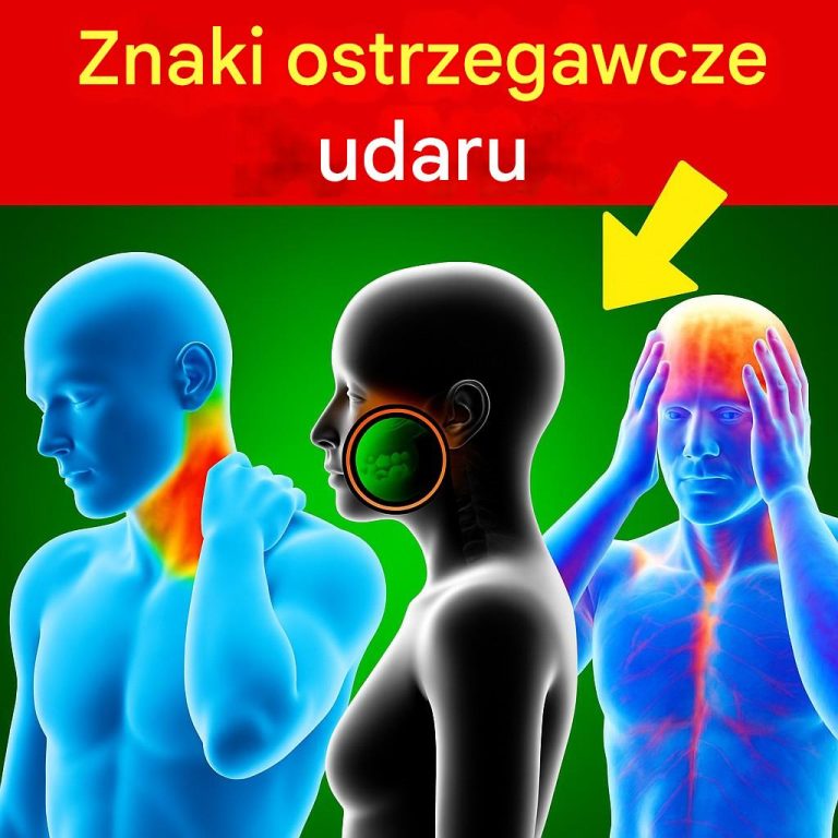 7 objawów udaru mózgu – co musisz wiedzieć!