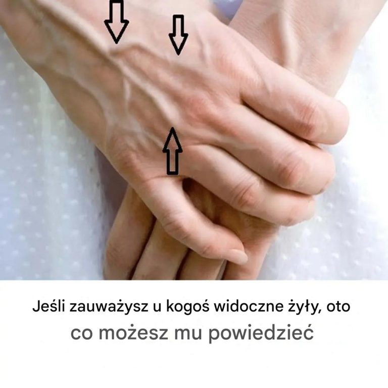 Tajemnice widocznych żył: co Twoja skóra mówi o Twoim zdrowiu