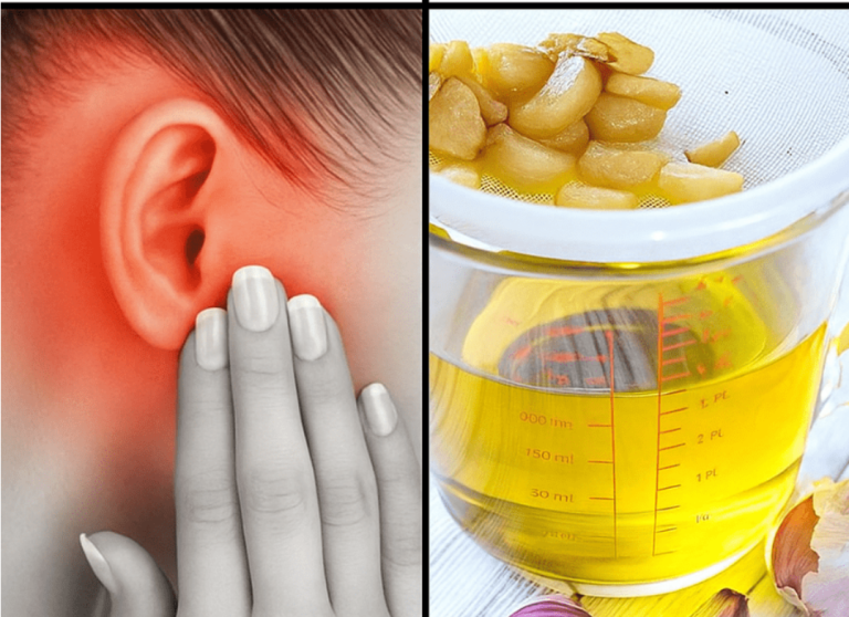 🧄Czosnek dla zdrowia uszu: naturalna ulga i ochrona, której możesz zaufać
