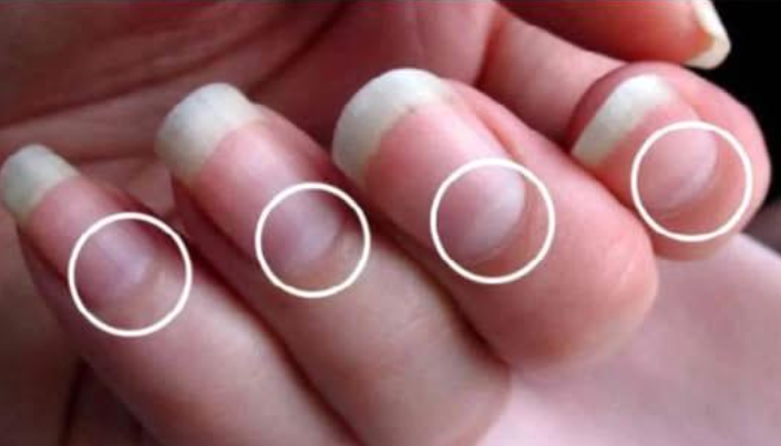 Fuerte Signif no Chase Blanches zdjęcia w Angeles?