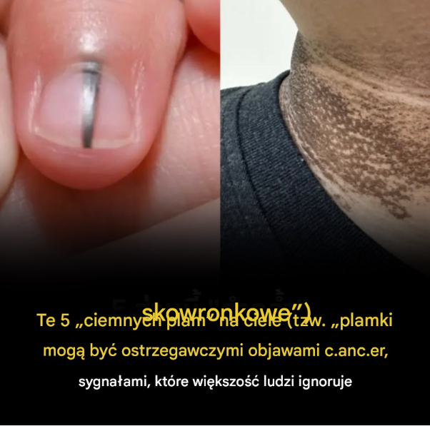 ostrzegawczych sygnałów przed atakiem raka, na które mało kto zwraca uwagę