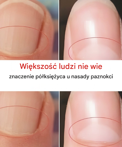 Co oznacza półksiężyc u podstawy paznokci?