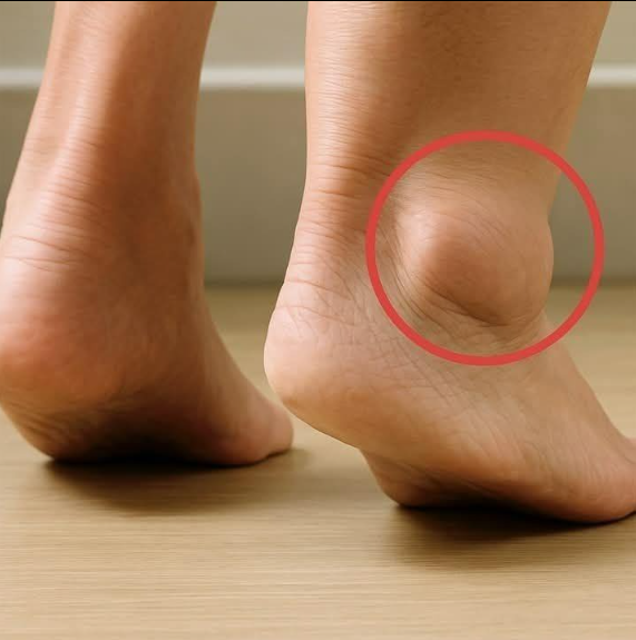 Opuchnięte nogi i stopy: przyczyny, objawy i naturalne metody łagodzenia